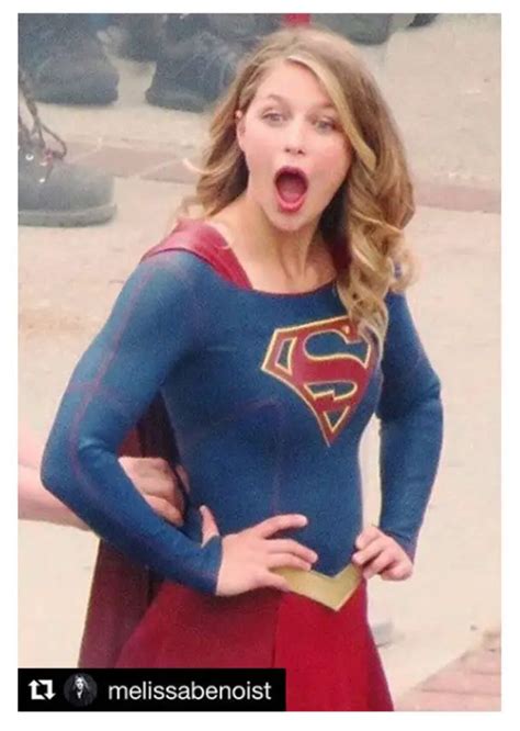 Melissa Benoist Archives